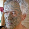 Prosthetics 22 of 54