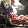 Prosthetics 35 of 54