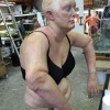 Prosthetics 39 of 54