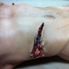 Prosthetics 25 of 54