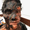Prosthetics 52 of 54