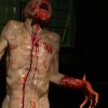 Prosthetics 32 of 54