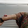Prosthetics 24 of 54